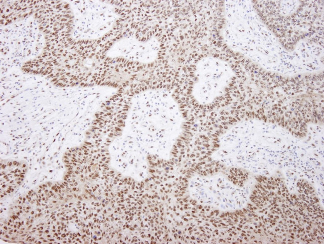 EFTUD2/SNRP116 Antibody in Immunohistochemistry (IHC)