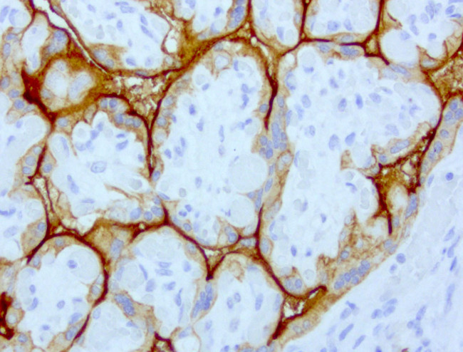 EGFR Antibody in Immunohistochemistry (Paraffin) (IHC (P))