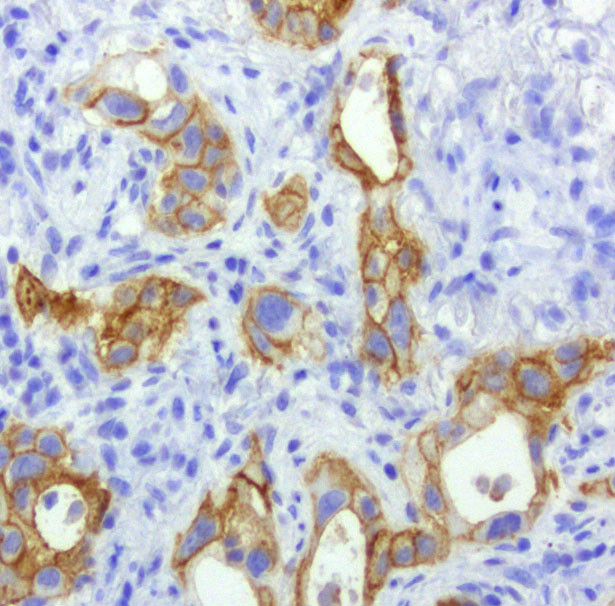 EGFR Antibody in Immunohistochemistry (Paraffin) (IHC (P))