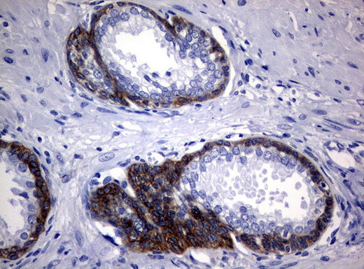 EGFR Antibody in Immunohistochemistry (Paraffin) (IHC (P))