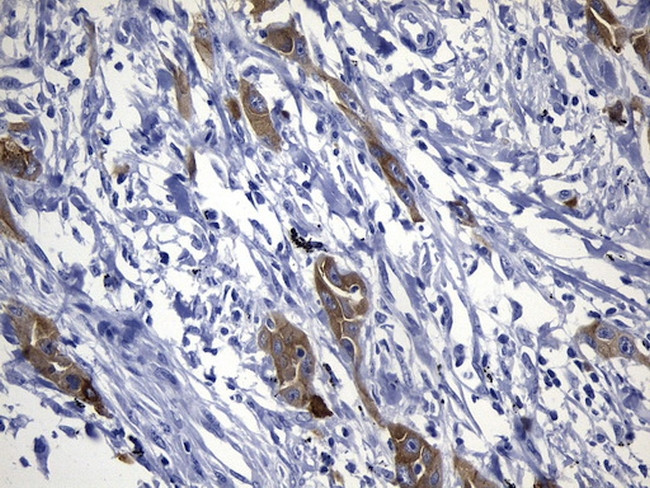 EGFR L858R Antibody in Immunohistochemistry (Paraffin) (IHC (P))