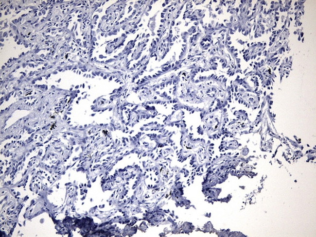 EGFR L858R Antibody in Immunohistochemistry (Paraffin) (IHC (P))