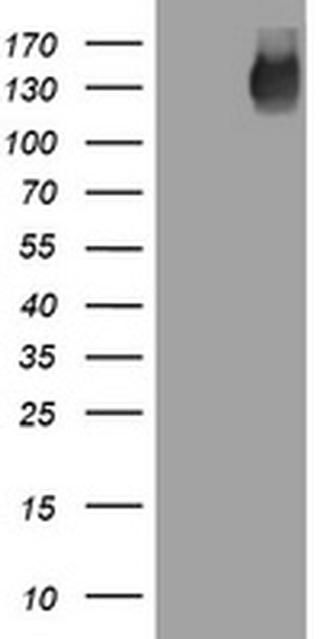 EGFR Antibody in Western Blot (WB)