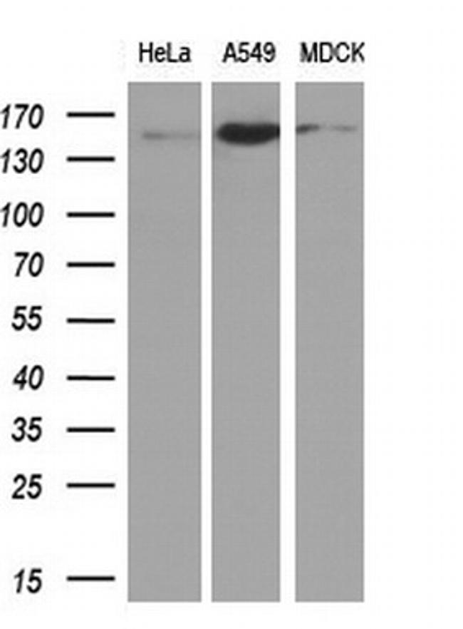 EGFR Antibody in Western Blot (WB)