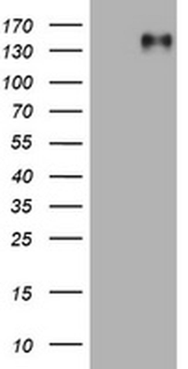 EGFR Antibody in Western Blot (WB)