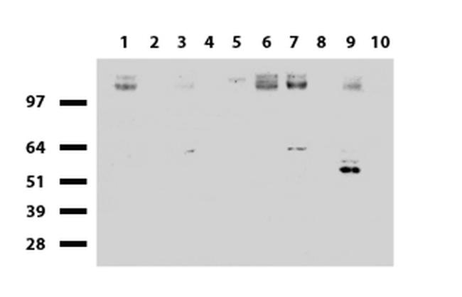 EGFR Antibody in Western Blot (WB)