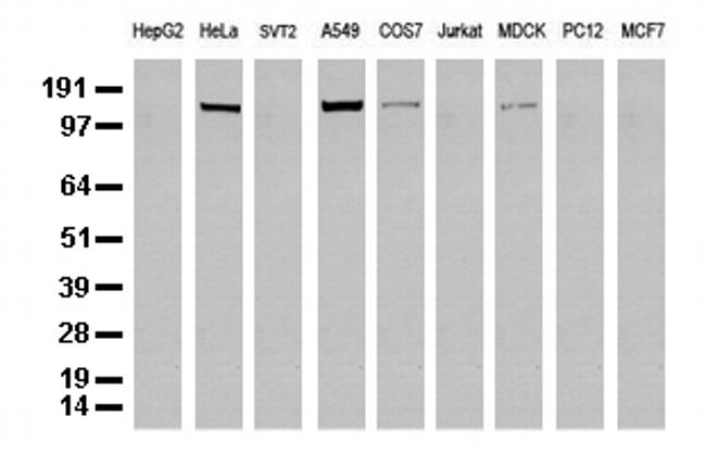 EGFR Antibody in Western Blot (WB)