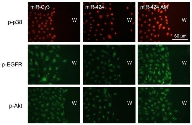 Phospho-EGFR (Tyr845) Antibody in Immunocytochemistry (ICC/IF)