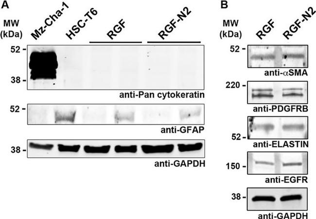 EGFR Antibody in Western Blot (WB)