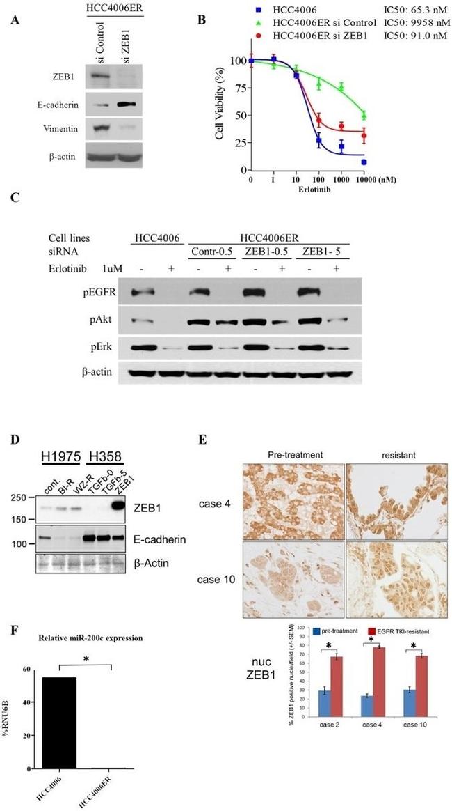 Phospho-EGFR (Tyr1068) Antibody in Western Blot (WB)