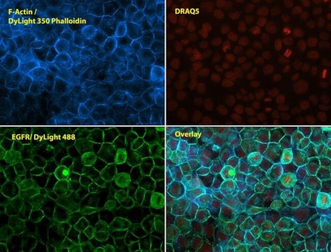 EGFR Antibody in Immunocytochemistry (ICC/IF)