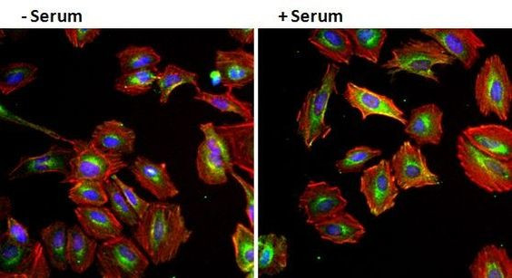 EGF Antibody in Immunocytochemistry (ICC/IF)