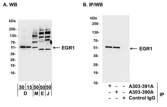 EGR1 Antibody in Western Blot (WB)