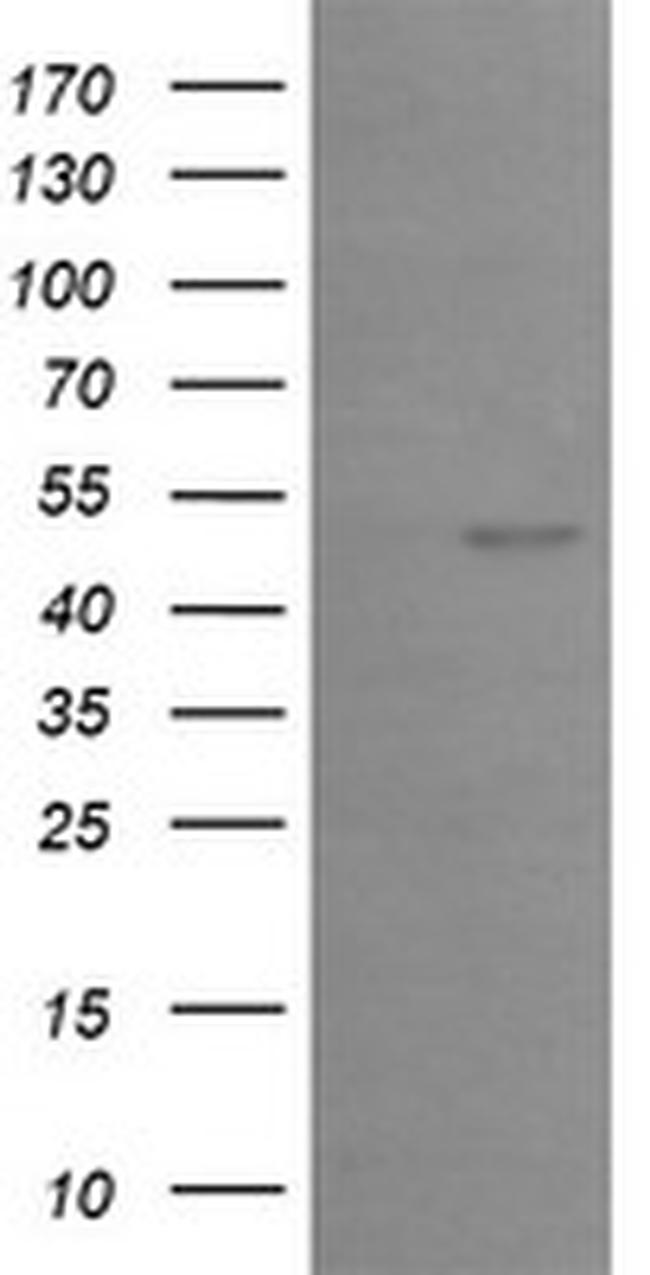 EGR2 Antibody in Western Blot (WB)