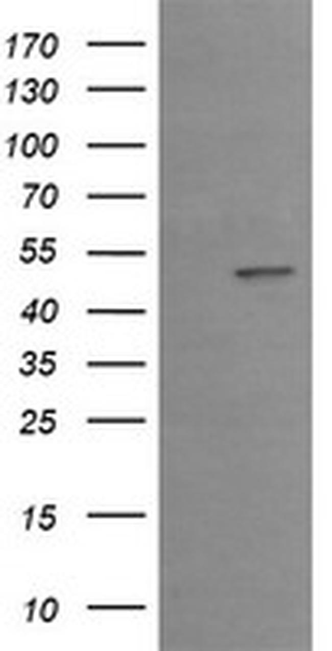 EGR2 Antibody in Western Blot (WB)