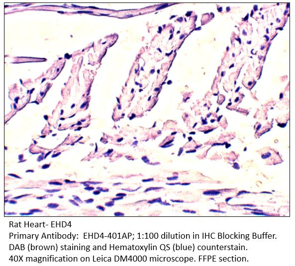 EHD4 Antibody in Immunohistochemistry (IHC)