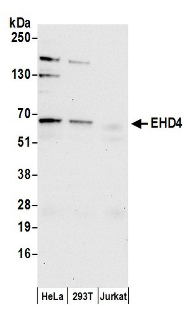 EHD4 Antibody in Western Blot (WB)