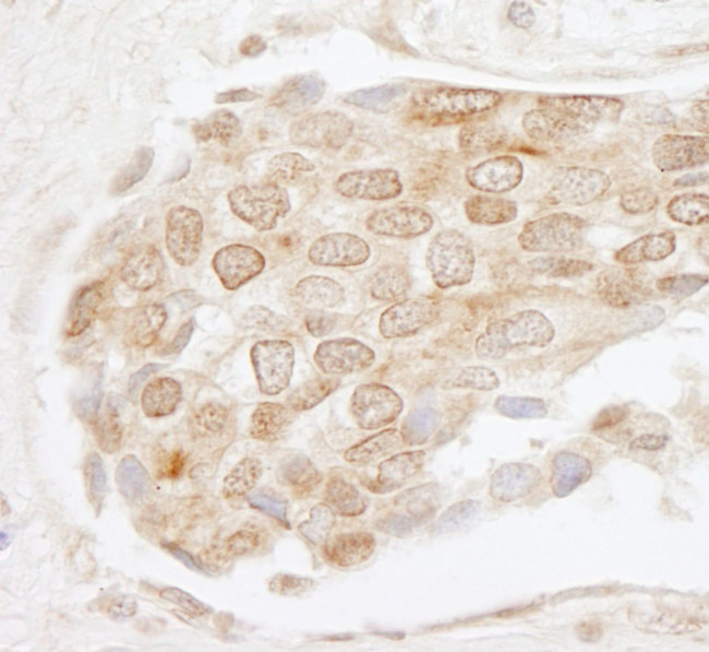 EHMT1 Antibody in Immunohistochemistry (IHC)