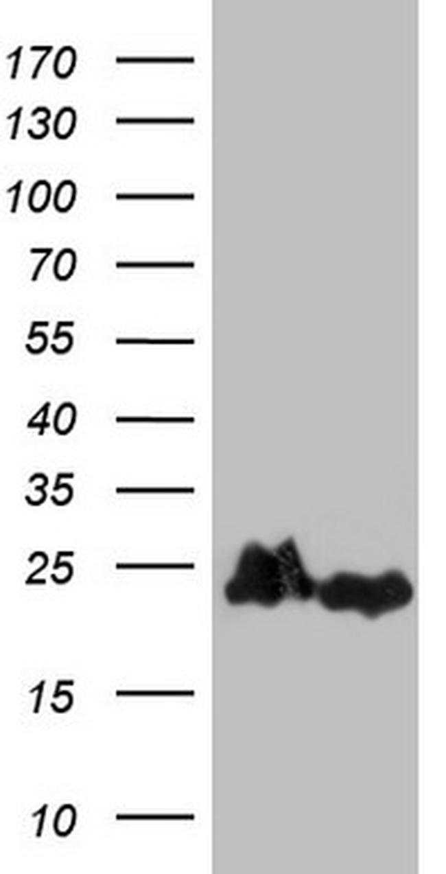 EIF1AY Antibody in Western Blot (WB)