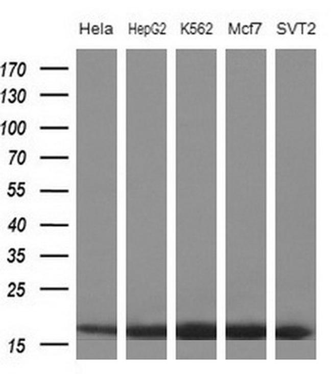 EIF1AY Antibody in Western Blot (WB)