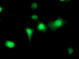 EIF2B3 Antibody in Immunocytochemistry (ICC/IF)