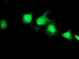 EIF2B3 Antibody in Immunocytochemistry (ICC/IF)