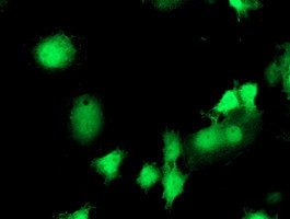 EIF2B3 Antibody in Immunocytochemistry (ICC/IF)