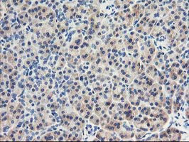 EIF2B3 Antibody in Immunohistochemistry (Paraffin) (IHC (P))