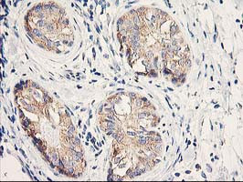 EIF2B3 Antibody in Immunohistochemistry (Paraffin) (IHC (P))