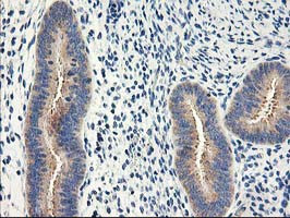 EIF2B3 Antibody in Immunohistochemistry (Paraffin) (IHC (P))