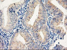 EIF2B3 Antibody in Immunohistochemistry (Paraffin) (IHC (P))