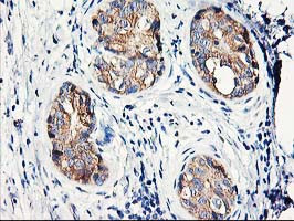 EIF2B3 Antibody in Immunohistochemistry (Paraffin) (IHC (P))