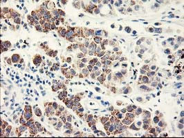 EIF2B3 Antibody in Immunohistochemistry (Paraffin) (IHC (P))