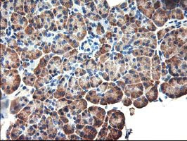 EIF2B3 Antibody in Immunohistochemistry (Paraffin) (IHC (P))