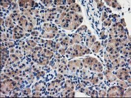 EIF2B3 Antibody in Immunohistochemistry (Paraffin) (IHC (P))