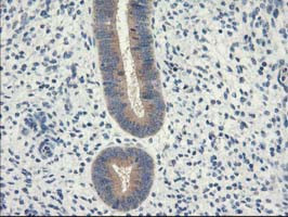 EIF2B3 Antibody in Immunohistochemistry (Paraffin) (IHC (P))