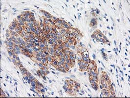 EIF2B3 Antibody in Immunohistochemistry (Paraffin) (IHC (P))