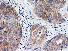 EIF2B3 Antibody in Immunohistochemistry (Paraffin) (IHC (P))