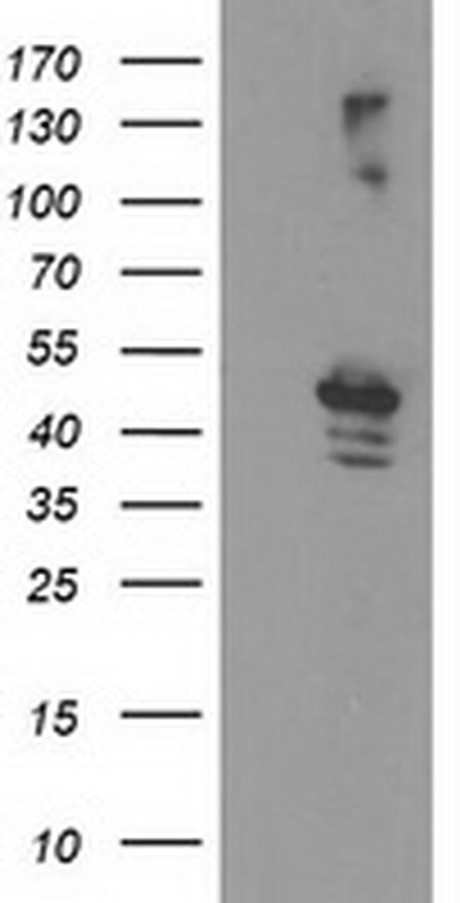 EIF2B3 Antibody in Western Blot (WB)