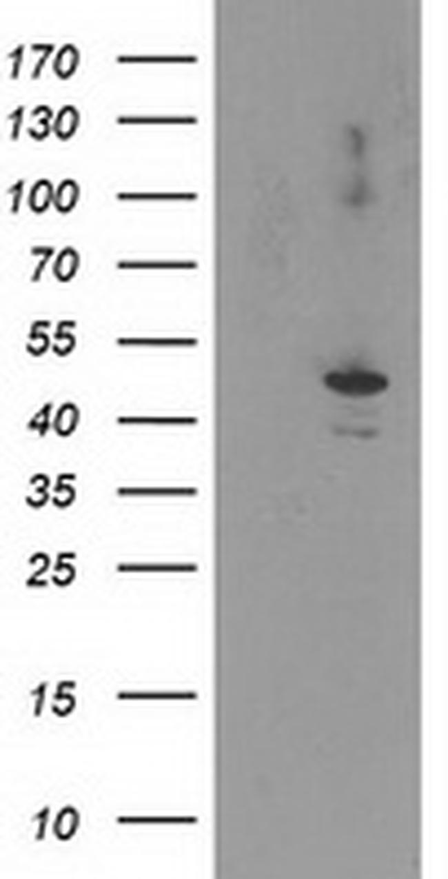 EIF2B3 Antibody in Western Blot (WB)