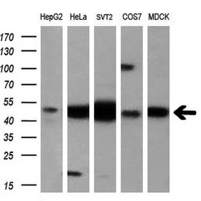 EIF2B3 Antibody in Western Blot (WB)