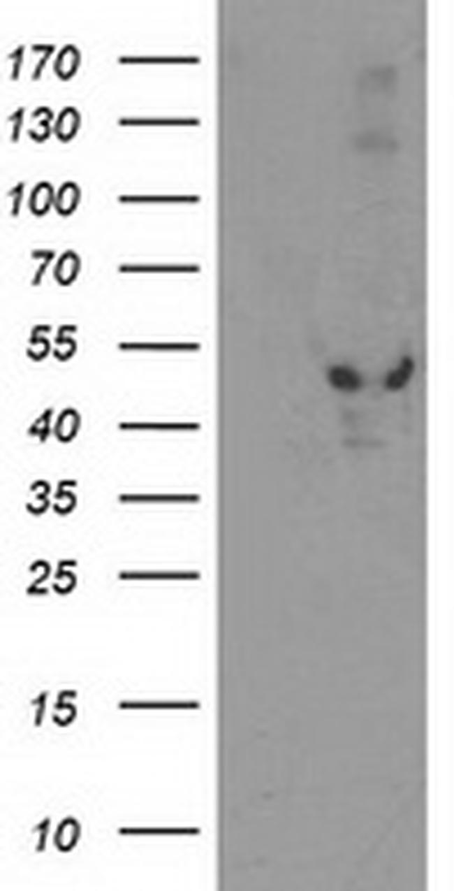 EIF2B3 Antibody in Western Blot (WB)