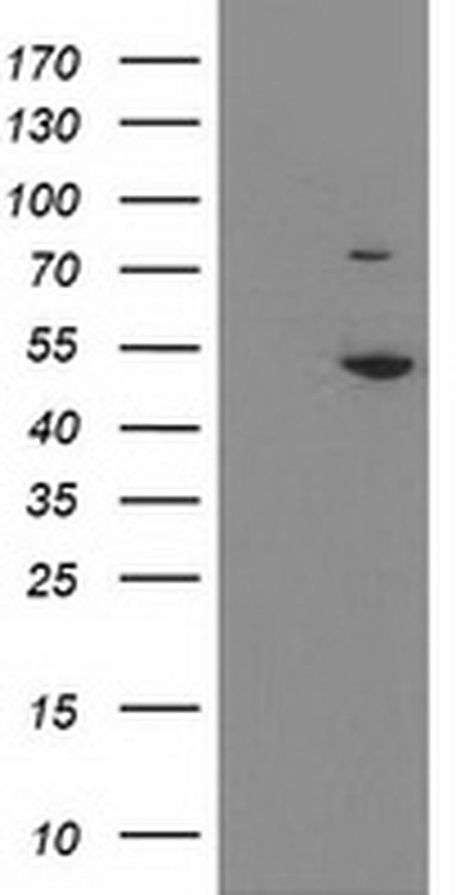 EIF2B3 Antibody in Western Blot (WB)
