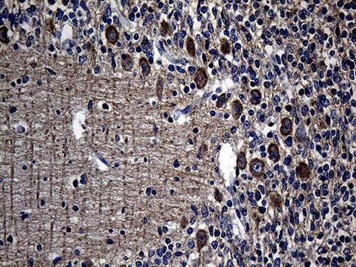 EIF2C1 Antibody in Immunohistochemistry (Paraffin) (IHC (P))