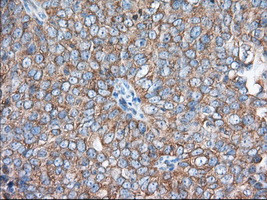 EIF2S1 Antibody in Immunohistochemistry (Paraffin) (IHC (P))