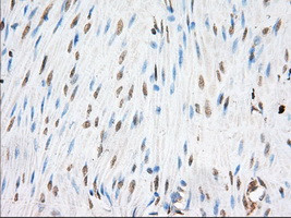 EIF2S1 Antibody in Immunohistochemistry (Paraffin) (IHC (P))