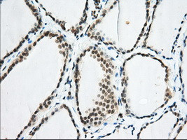 EIF2S1 Antibody in Immunohistochemistry (Paraffin) (IHC (P))