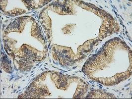 EIF2S1 Antibody in Immunohistochemistry (Paraffin) (IHC (P))