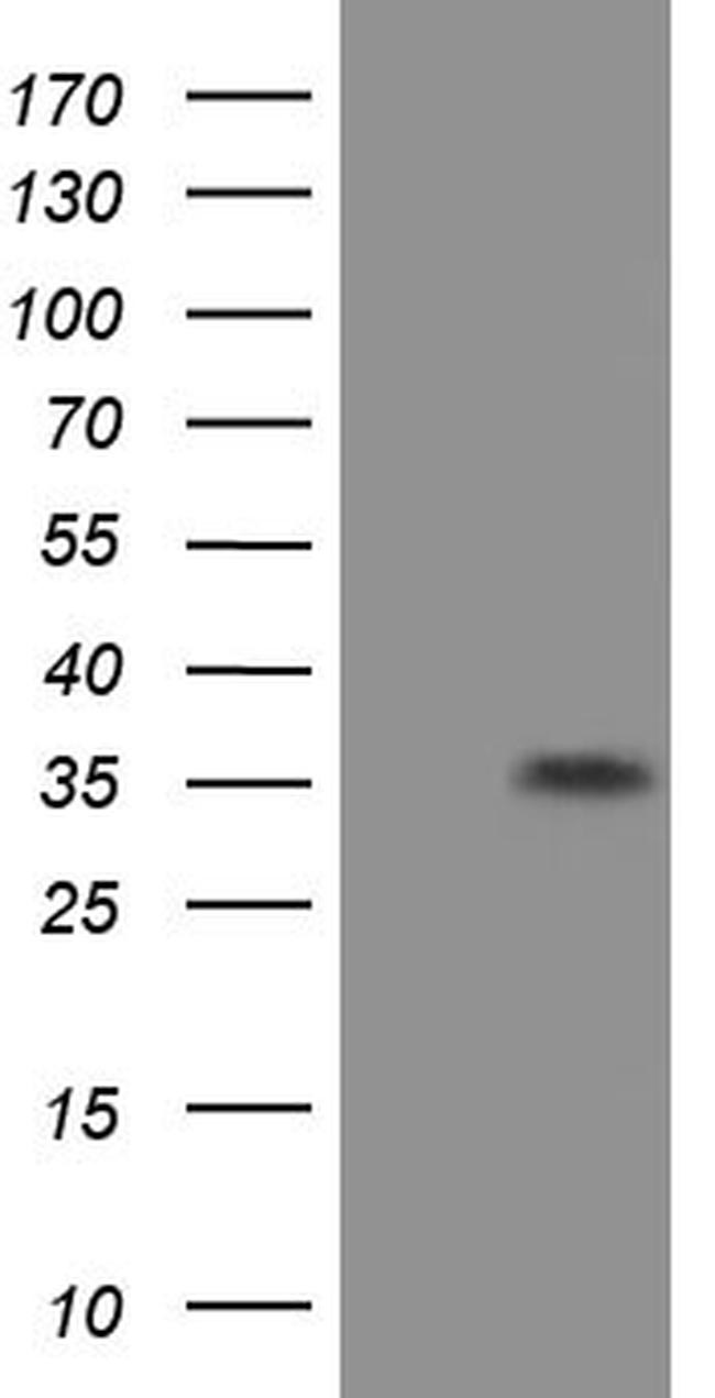 EIF2S1 Antibody in Western Blot (WB)