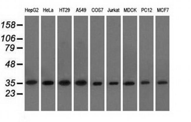 EIF2S1 Antibody in Western Blot (WB)